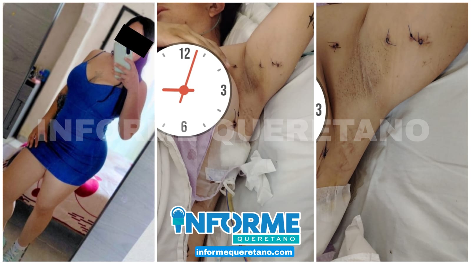 SEÑALAN A POLICÍA DE ATACAR CON ARMA BLANCA A SU NOVIA